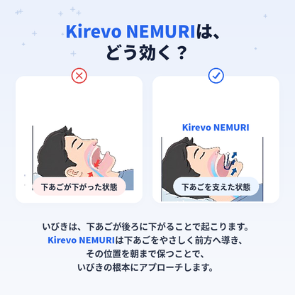 KIREVO NEMURI™ いびきケアマウスピース